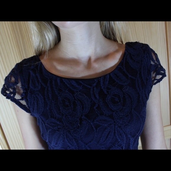 Blue lace dress - Picture 3 of 4